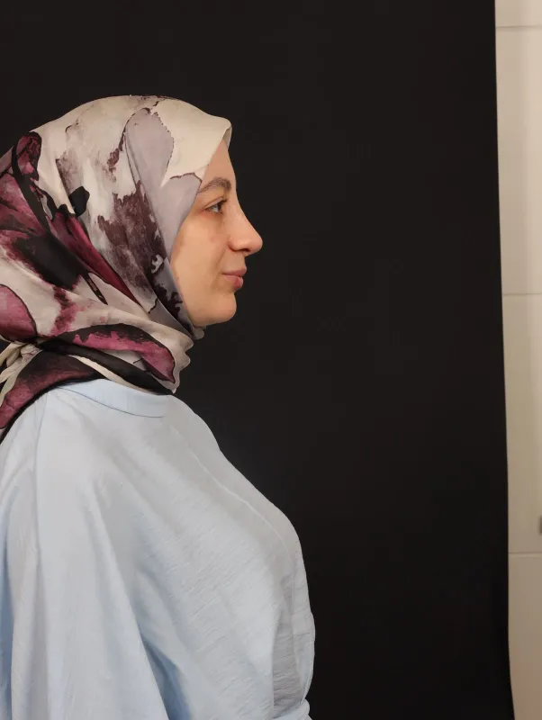 Revizyon Rinoplasti — ameliyat sonrası, çekim 26.08.2026