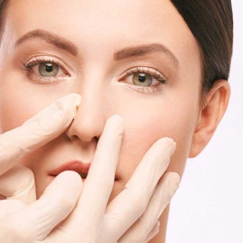 septoplasti